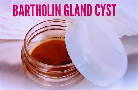 its not on your labia, rather inside of it just to the side of your vaginal opening. . Best antibiotic for bartholin cyst